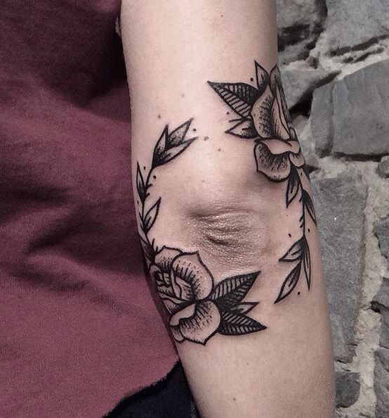 Black roses around the elbow